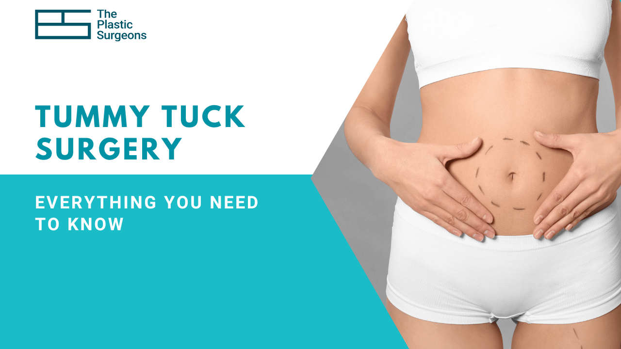 Is Tummy Tuck Surgery Right for Me? Everything You Need to Know