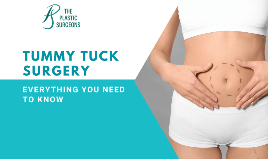 Is Tummy Tuck Surgery Right for Me? Everything You Need to Know