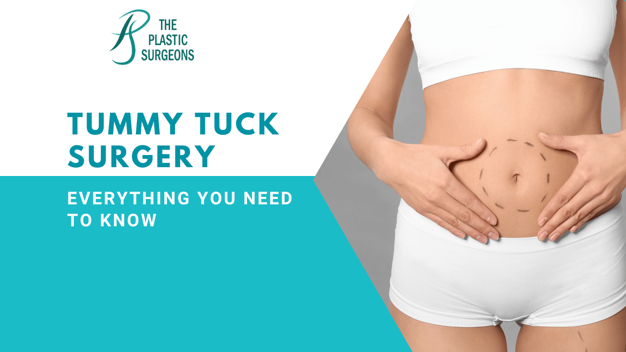 Is Tummy Tuck Surgery Right for Me? Everything You Need to Know