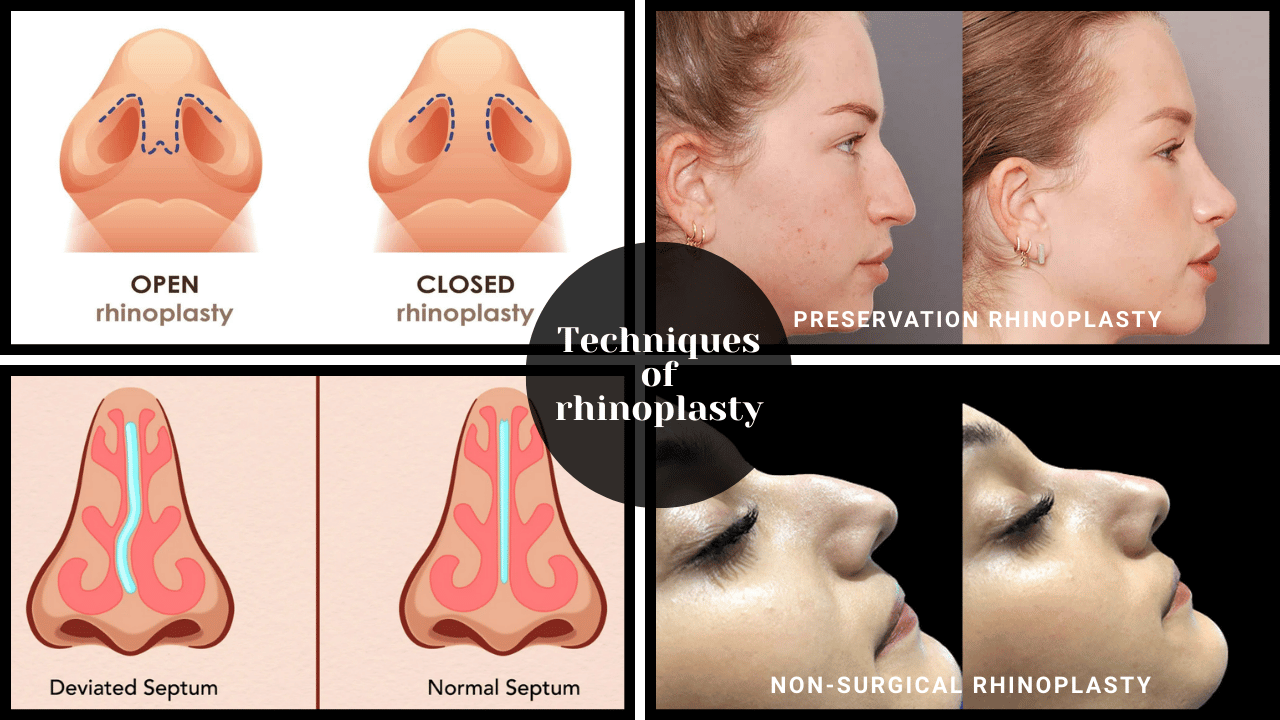 Popular Techniques for Achieving a Natural Look