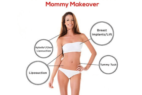 Understanding What a Mommy Makeover Really Is