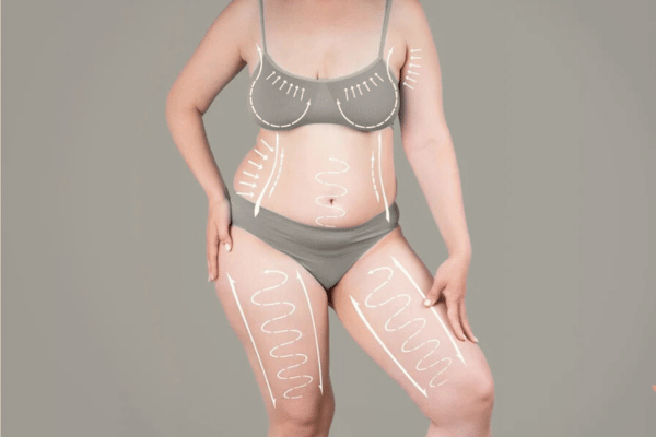 safety,risk of mommy makeover