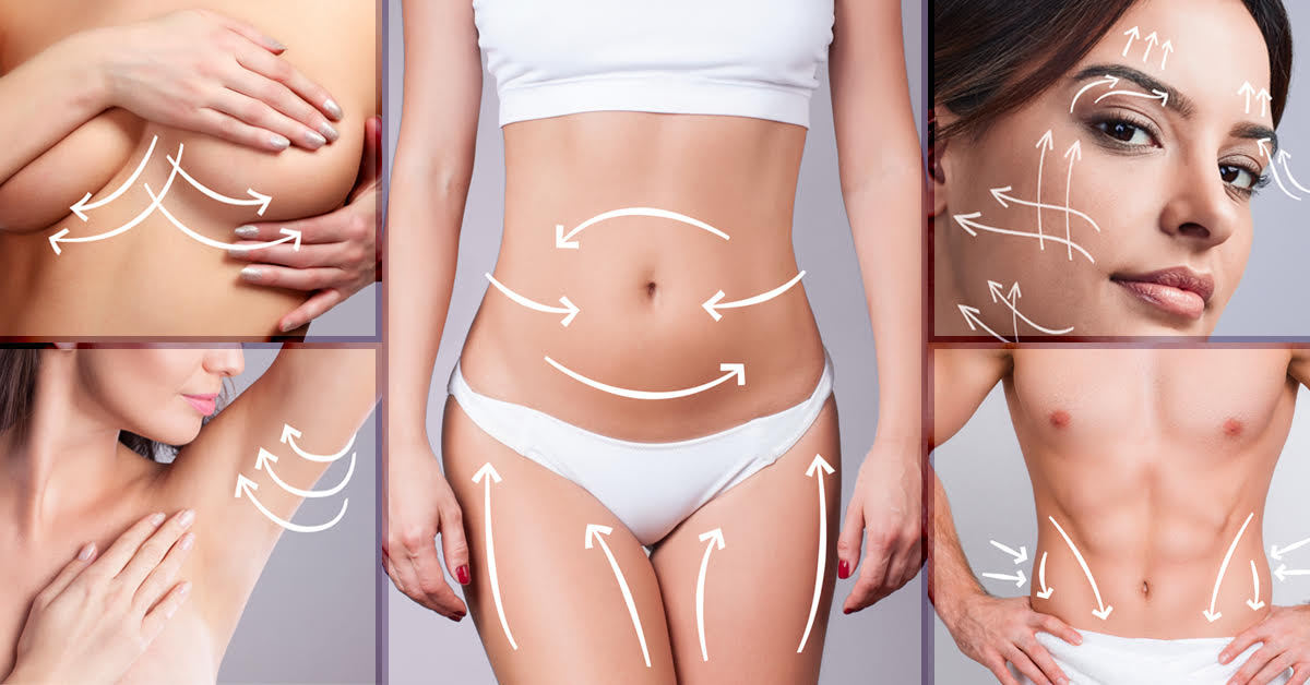 Understanding Body Contouring