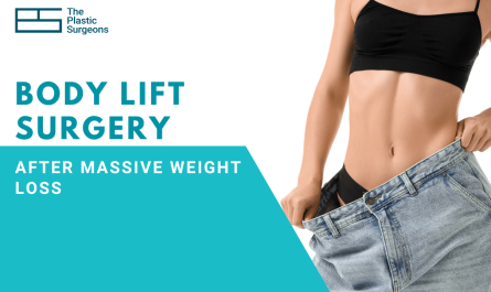 Body Lift Surgery After Massive Weight Loss: What You Should Know