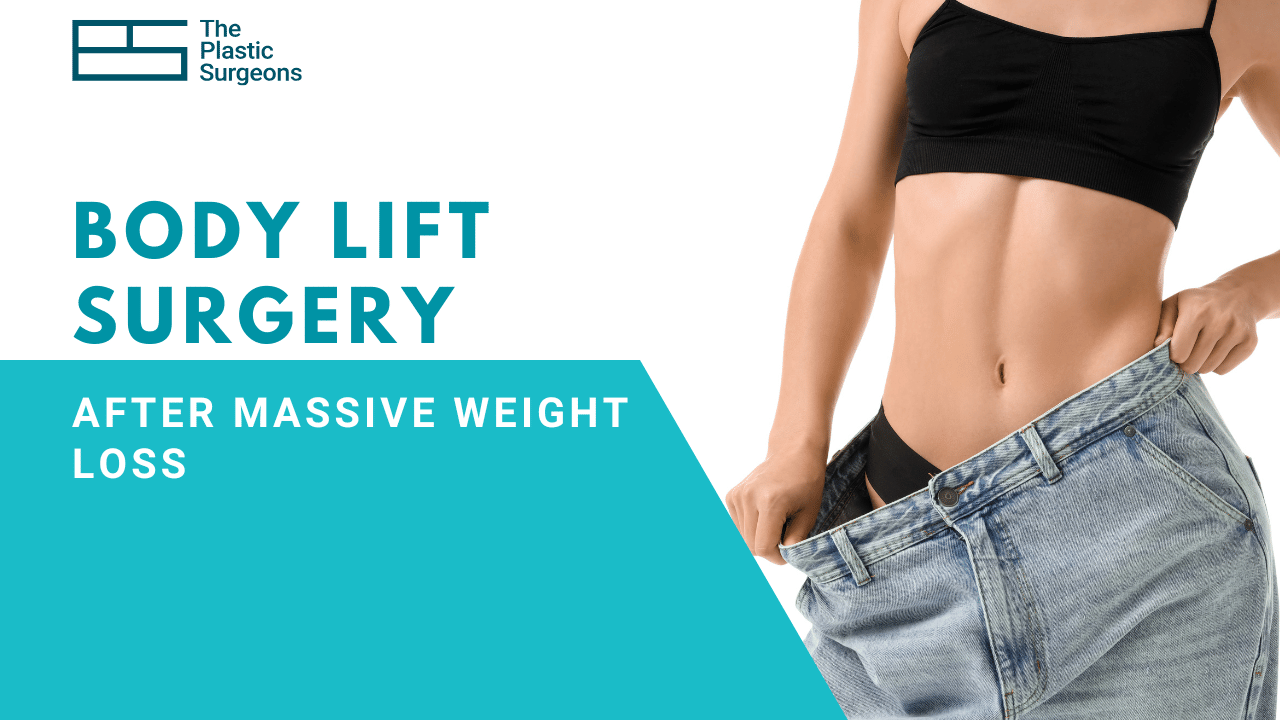 Body Lift Surgery After Massive Weight Loss: What You Should Know