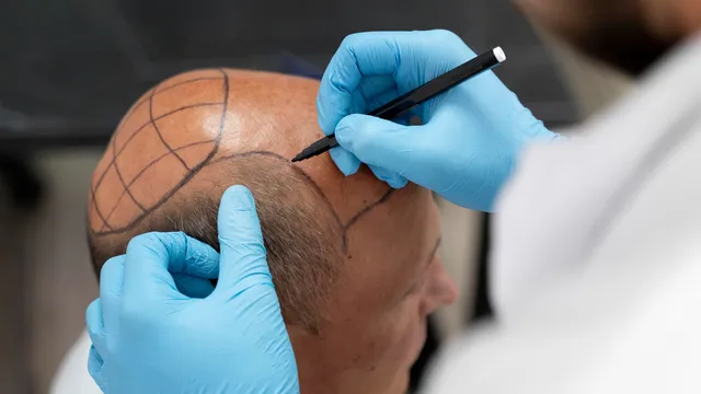 Is It Worth It Financially After 40?