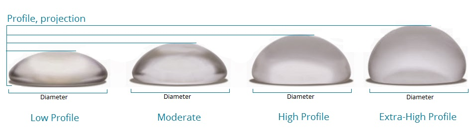 The Role of Implant Shape and Profile