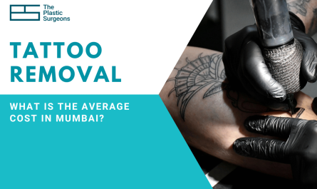 What Is the Average Cost of Tattoo Removal in Mumbai?