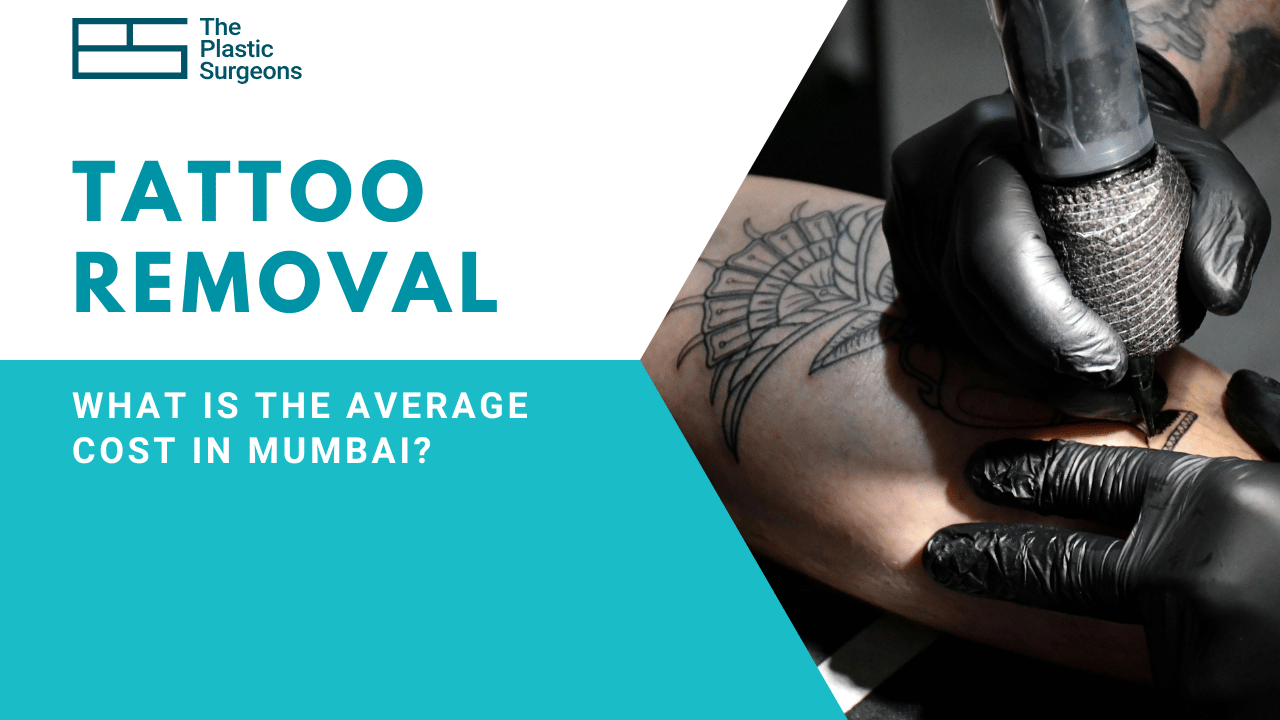 What Is the Average Cost of Tattoo Removal in Mumbai?