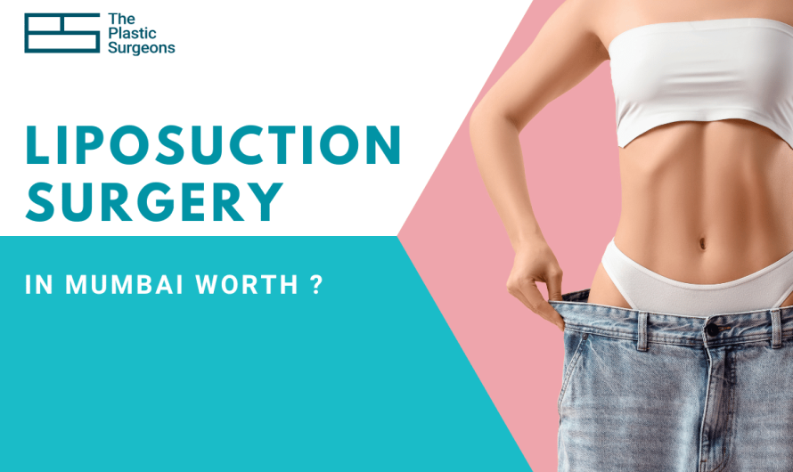 Is Liposuction Surgery in Mumbai Worth the Investment?