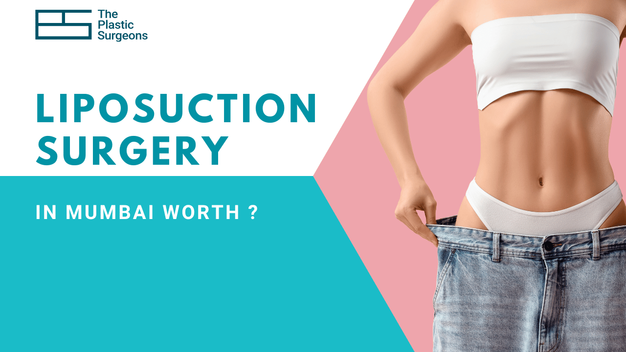 Is Liposuction Surgery in Mumbai Worth the Investment?