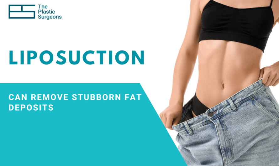 Can Liposuction Help Remove Stubborn Fat Deposits in Mumbai?