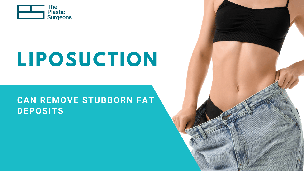 Can Liposuction Help Remove Stubborn Fat Deposits in Mumbai?
