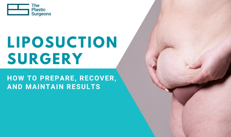 Liposuction Surgery: How to Prepare, Recover, and Maintain Results