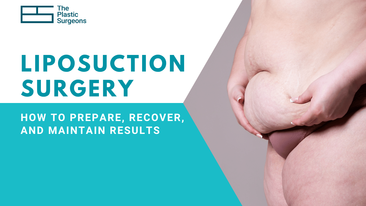 Liposuction Surgery: How to Prepare, Recover, and Maintain Results