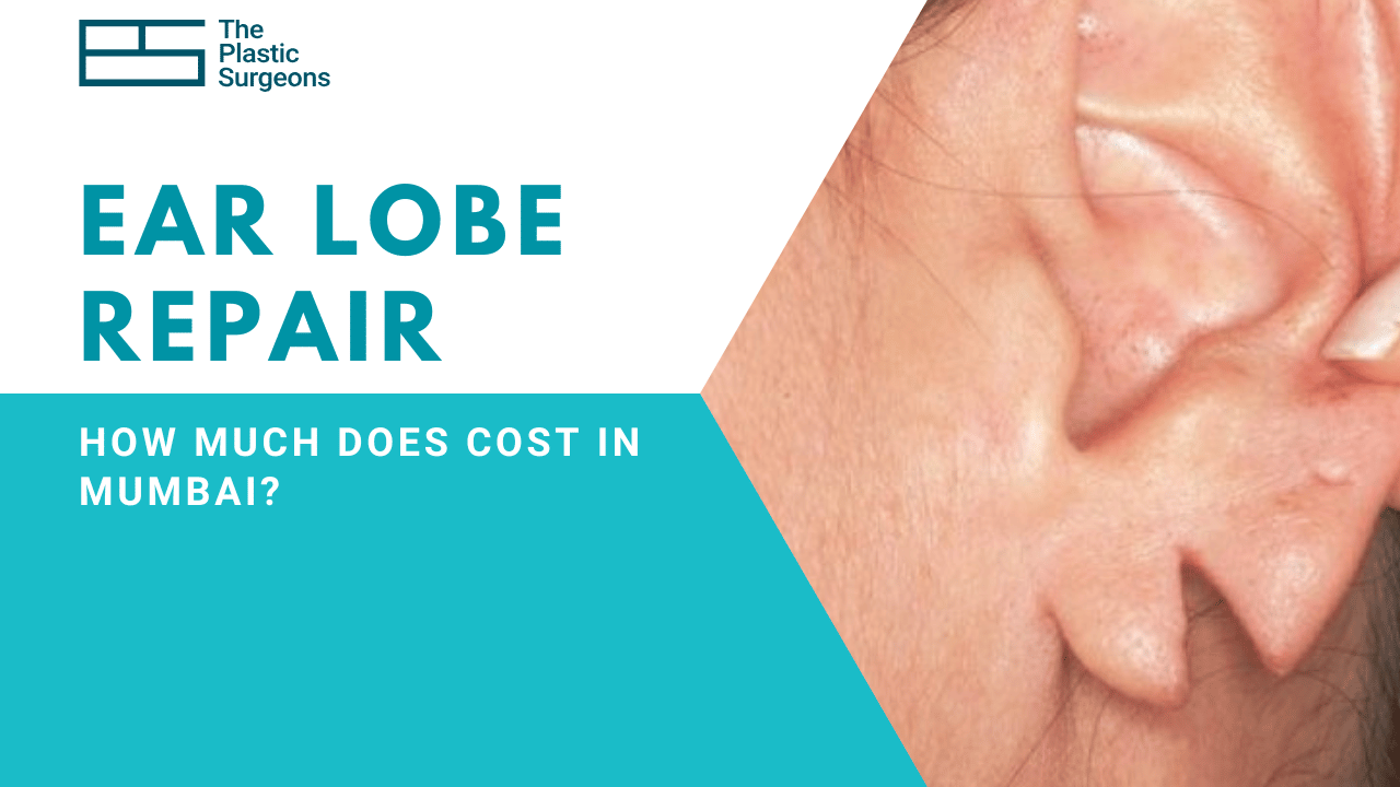 How Much Does Ear Lobe Repair Surgery Cost in Mumbai?
