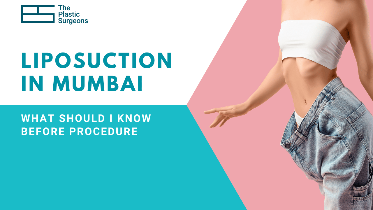 What Should I Know Before Getting Liposuction in Mumbai?
