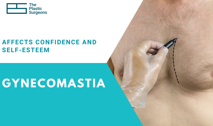How Gynecomastia Treatment in Mumbai Can Improve Confidence and Self-Esteem