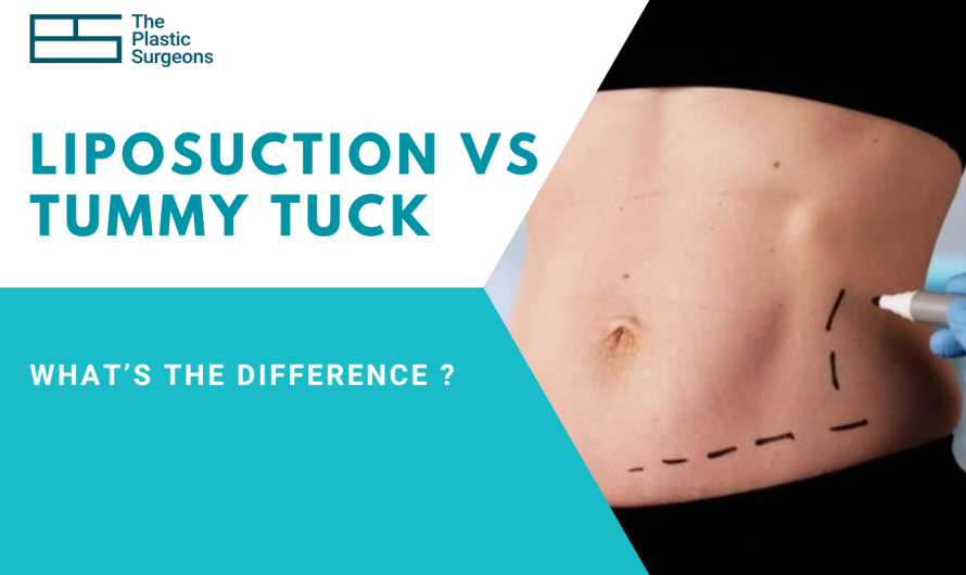 What’s the Difference Between Liposuction and Tummy Tuck in Mumbai?