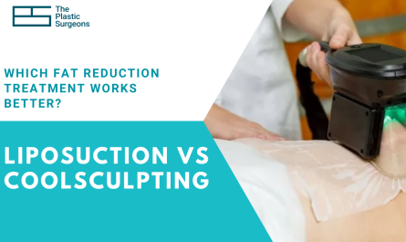 liposuction-vs-coolsculpting-which-fat-reduction-treatment-works-better