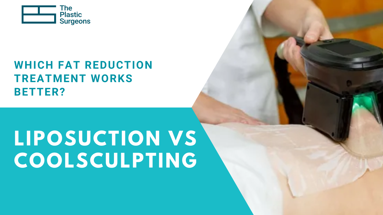 liposuction-vs-coolsculpting-which-fat-reduction-treatment-works-better