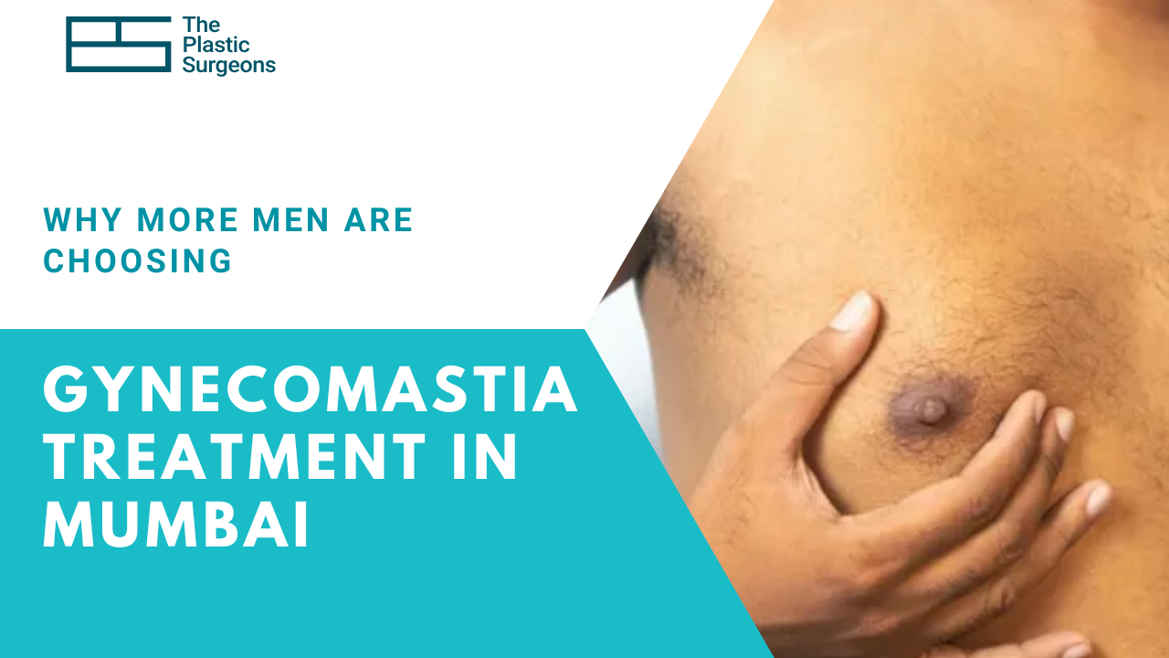 why-more-men-are-choosing-gynecomastia-treatment