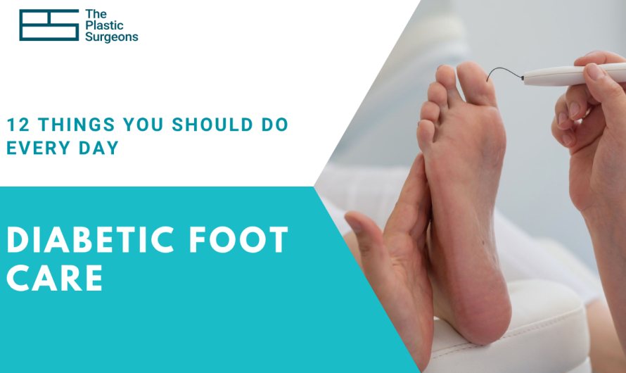 Diabetic Foot Care: 12 Things You Should Do Every Day