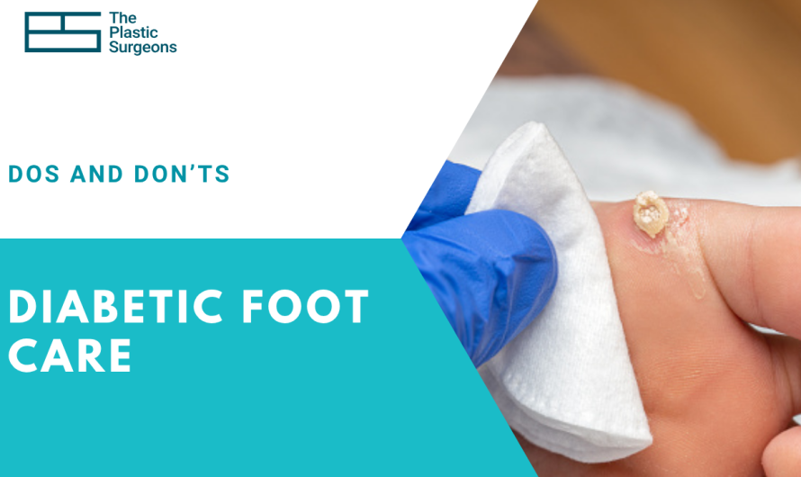 Diabetic Foot Care: Dos and Don’ts