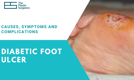 diabetic-foot-ulcer-causes-symptoms-and-complications