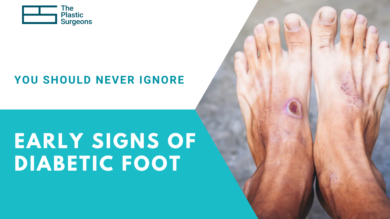 early-signs-of-diabetic-foot-you-should-never-ignore