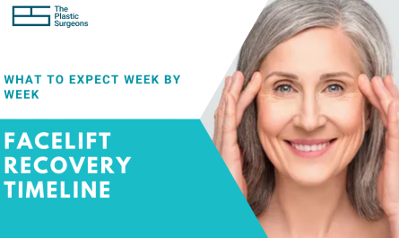 facelift-recovery-timeline-what-to-expect-week-by-week