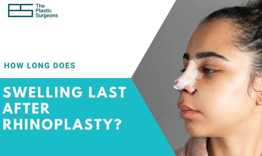 How Long Does Swelling Last After Rhinoplasty? A Complete Recovery Timeline