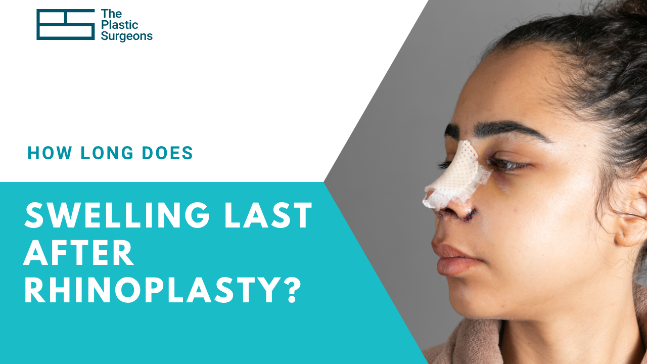 how-long-does-swelling-last-after-rhinoplasty
