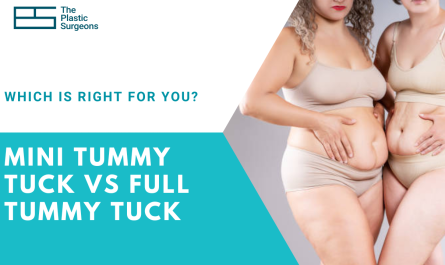 mini-tummy-tuck-vs-full-tummy-tuck-which-is-right-for-you