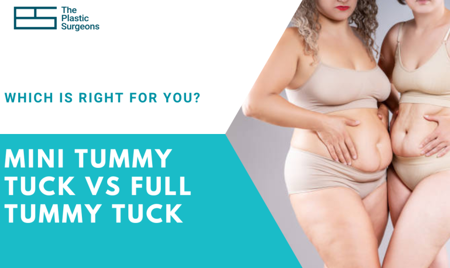Mini Tummy Tuck vs Full Tummy Tuck: Which Is Right for You?