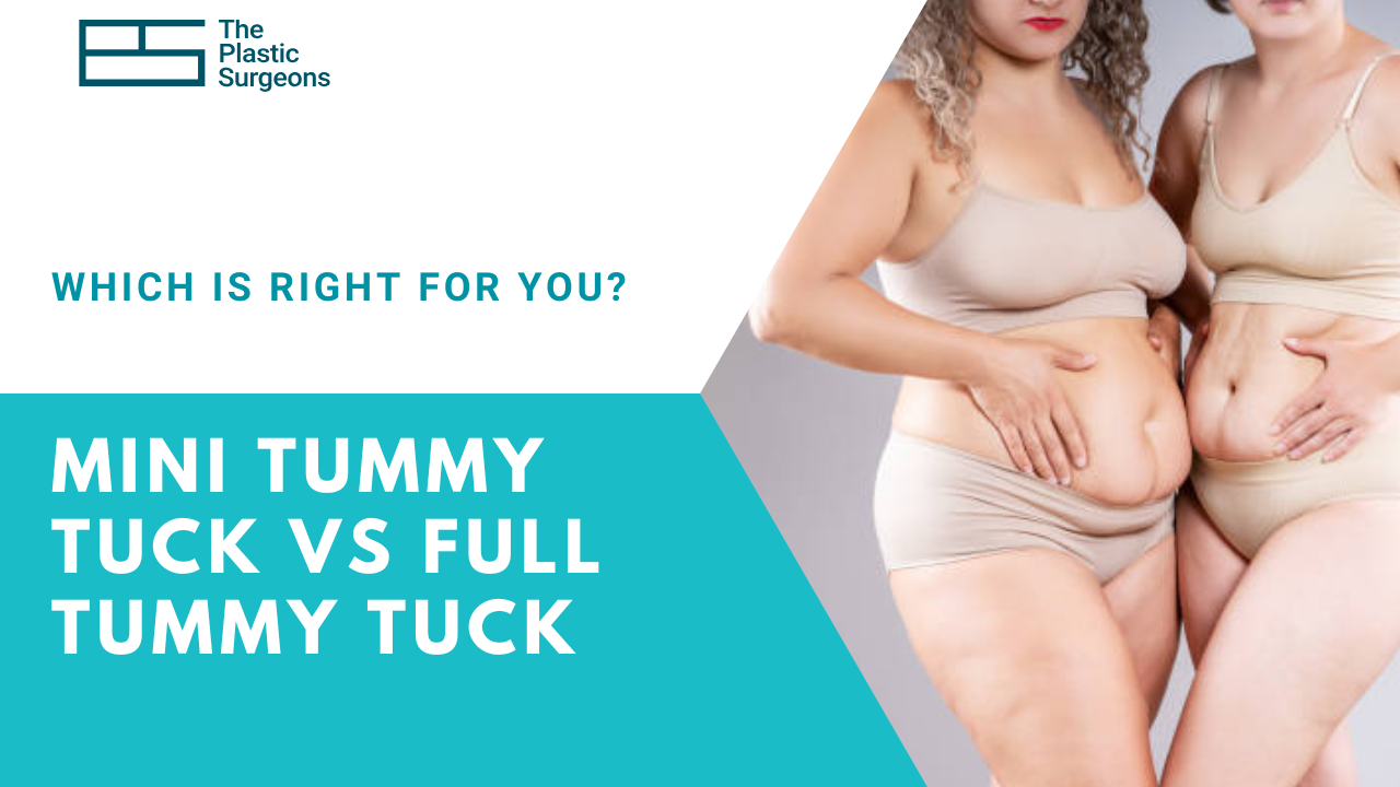 mini-tummy-tuck-vs-full-tummy-tuck-which-is-right-for-you