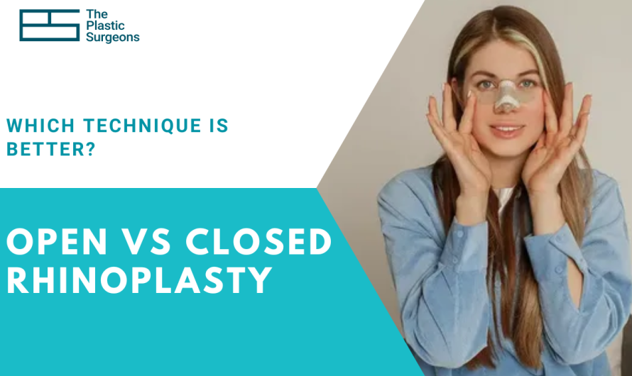 Open vs Closed Rhinoplasty: Which Technique Is Better?