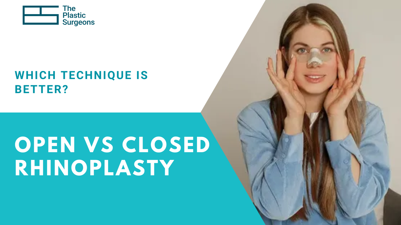 open-vs-closed-rhinoplasty-which-technique-is-better