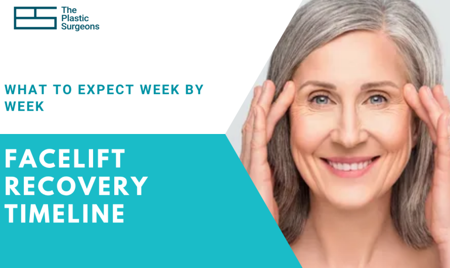 Facelift Recovery Timeline: What to Expect Week by Week