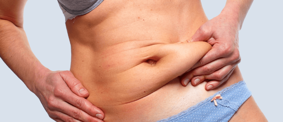 Post Cesarean Scar Apron Repair :: Cosmetic & Reconstructive